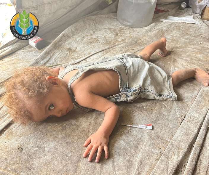 مناشدة عاجلة من شمال غزة: الجوع يفتك بالنازحين والحصار يشتد